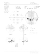 静的視野解析結果